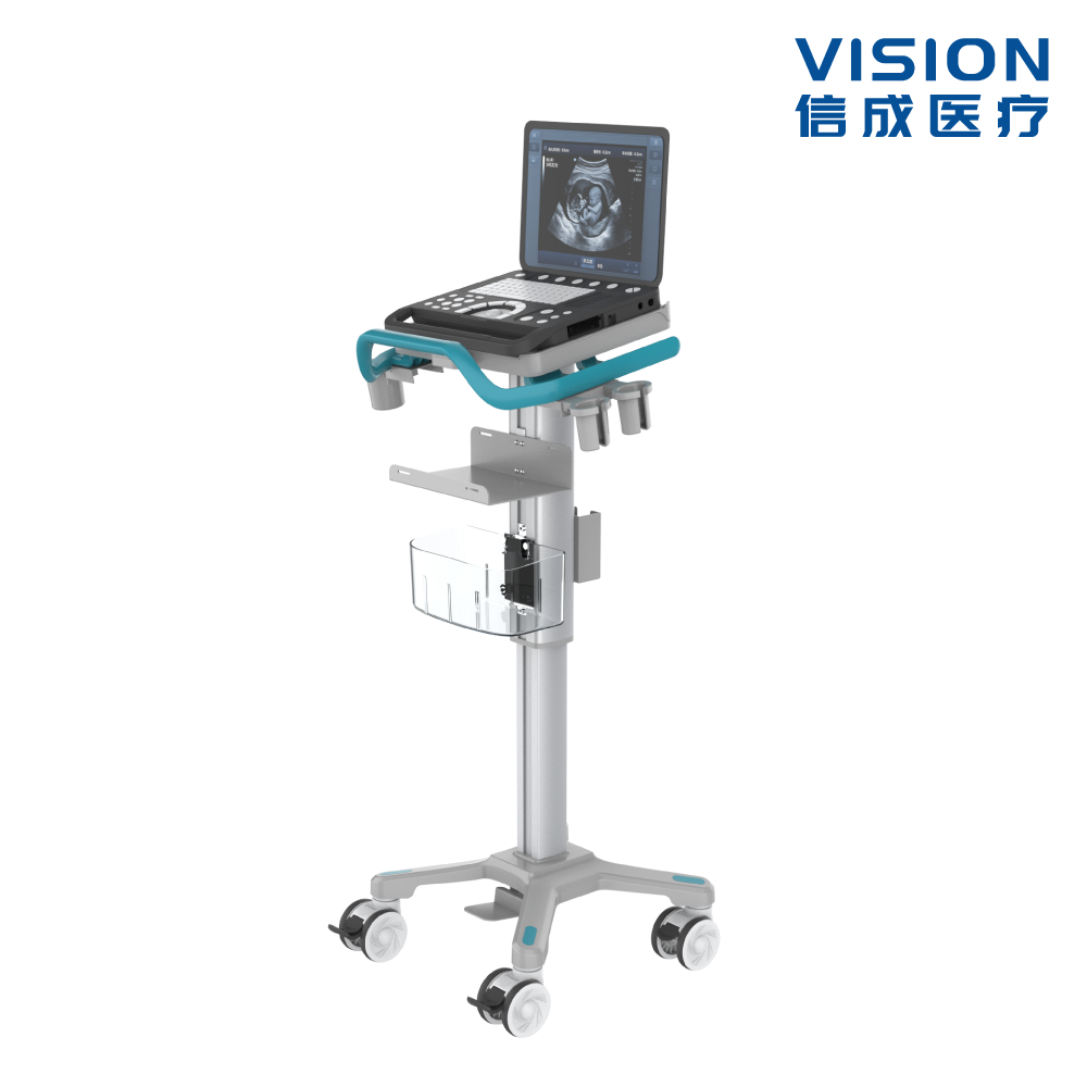 Portable Ultrasound Cart (Lightweight Mobile · Storage Basket)